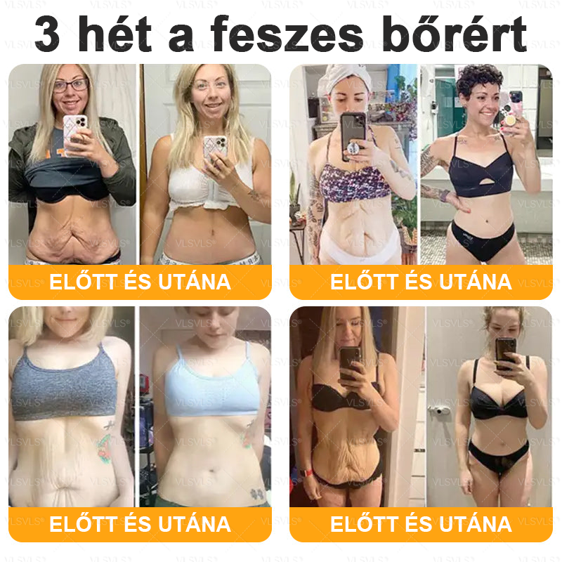 👩‍⚕️✨ VLSVLS® Méhméreg Komplex Krém – Utolsó nap: 80% kedvezmény! (A bőr megereszkedésének, finom ráncoknak, feszesség elvesztésének, lapos melleknek, petyhüdt fenéknek és egyéb problémáknak a javítására)