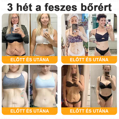 👩‍⚕️✨ VLSVLS® Méhméreg Komplex Krém – Utolsó nap: 80% kedvezmény! (A bőr megereszkedésének, finom ráncoknak, feszesség elvesztésének, lapos melleknek, petyhüdt fenéknek és egyéb problémáknak a javítására)