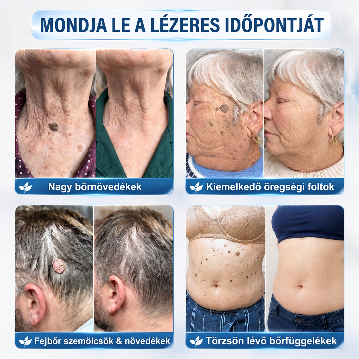 HISKIN® 🎁🎁🎁 Csak 10 csomag maradt! További 50% kedvezményt biztosítunk Önnek! Ne maradjon le róla most, mert erre az ajánlatra legközelebb csak jövőre lesz lehetősége.