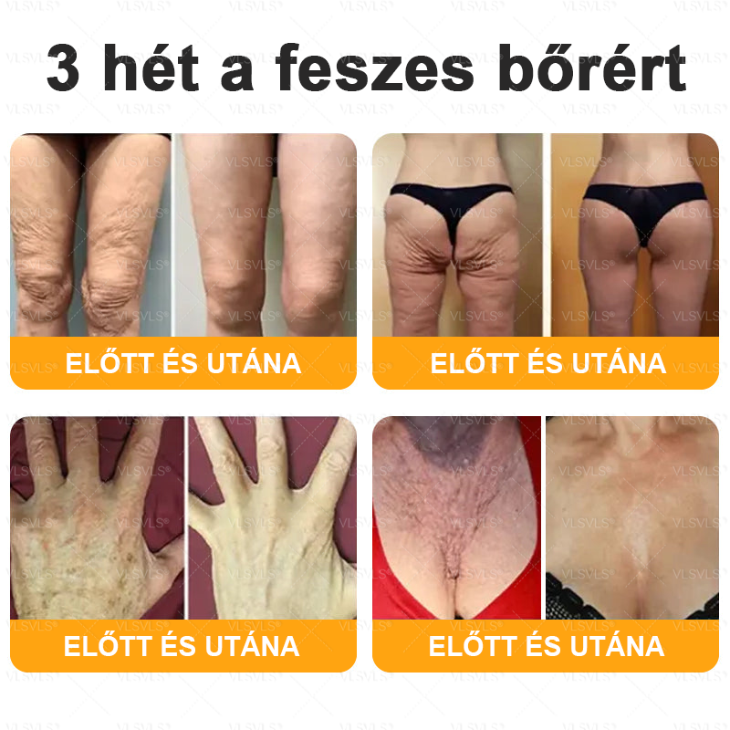 👩‍⚕️✨ VLSVLS® Méhméreg Komplex Krém – Utolsó nap: 80% kedvezmény! (A bőr megereszkedésének, finom ráncoknak, feszesség elvesztésének, lapos melleknek, petyhüdt fenéknek és egyéb problémáknak a javítására)