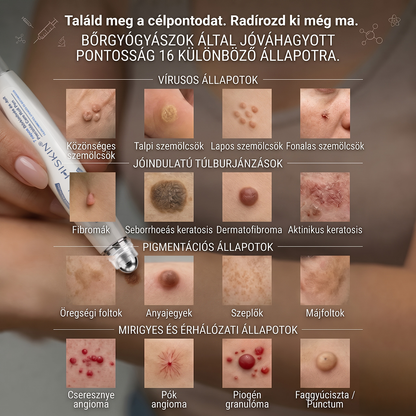 HISKIN® 🎁🎁🎁 Csak 10 csomag maradt! További 50% kedvezményt biztosítunk Önnek! Ne maradjon le róla most, mert erre az ajánlatra legközelebb csak jövőre lesz lehetősége.