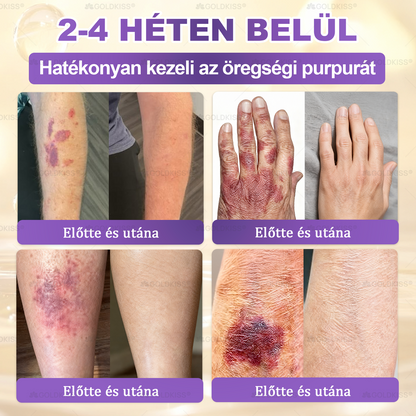 🇭🇺 Magyarországon gyártva és szállítva ✨ 𝐆𝐎𝐋𝐃𝐊𝐈𝐒𝐒® 𝐆𝐇𝐊-𝐂𝐮 & 𝐁𝐈𝐎𝐓𝐈𝐍 𝟏𝟎-𝐢𝐧-𝟏 Bőrmegújító Krém ⚡