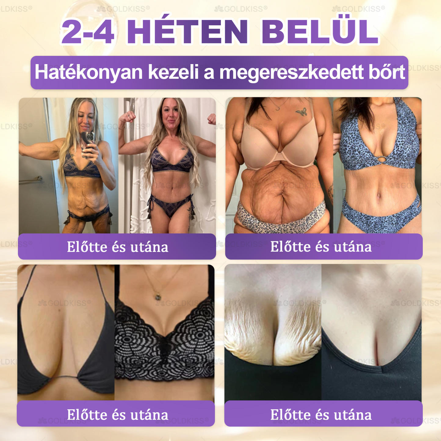 🇭🇺 Magyarországon gyártva és szállítva ✨ 𝐆𝐎𝐋𝐃𝐊𝐈𝐒𝐒® 𝐆𝐇𝐊-𝐂𝐮 & 𝐁𝐈𝐎𝐓𝐈𝐍 𝟏𝟎-𝐢𝐧-𝟏 Bőrmegújító Krém ⚡