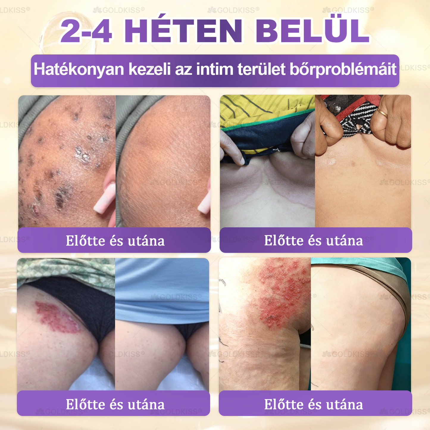 🇭🇺 Magyarországon gyártva és szállítva ✨ 𝐆𝐎𝐋𝐃𝐊𝐈𝐒𝐒® 𝐆𝐇𝐊-𝐂𝐮 & 𝐁𝐈𝐎𝐓𝐈𝐍 𝟏𝟎-𝐢𝐧-𝟏 Bőrmegújító Krém ⚡