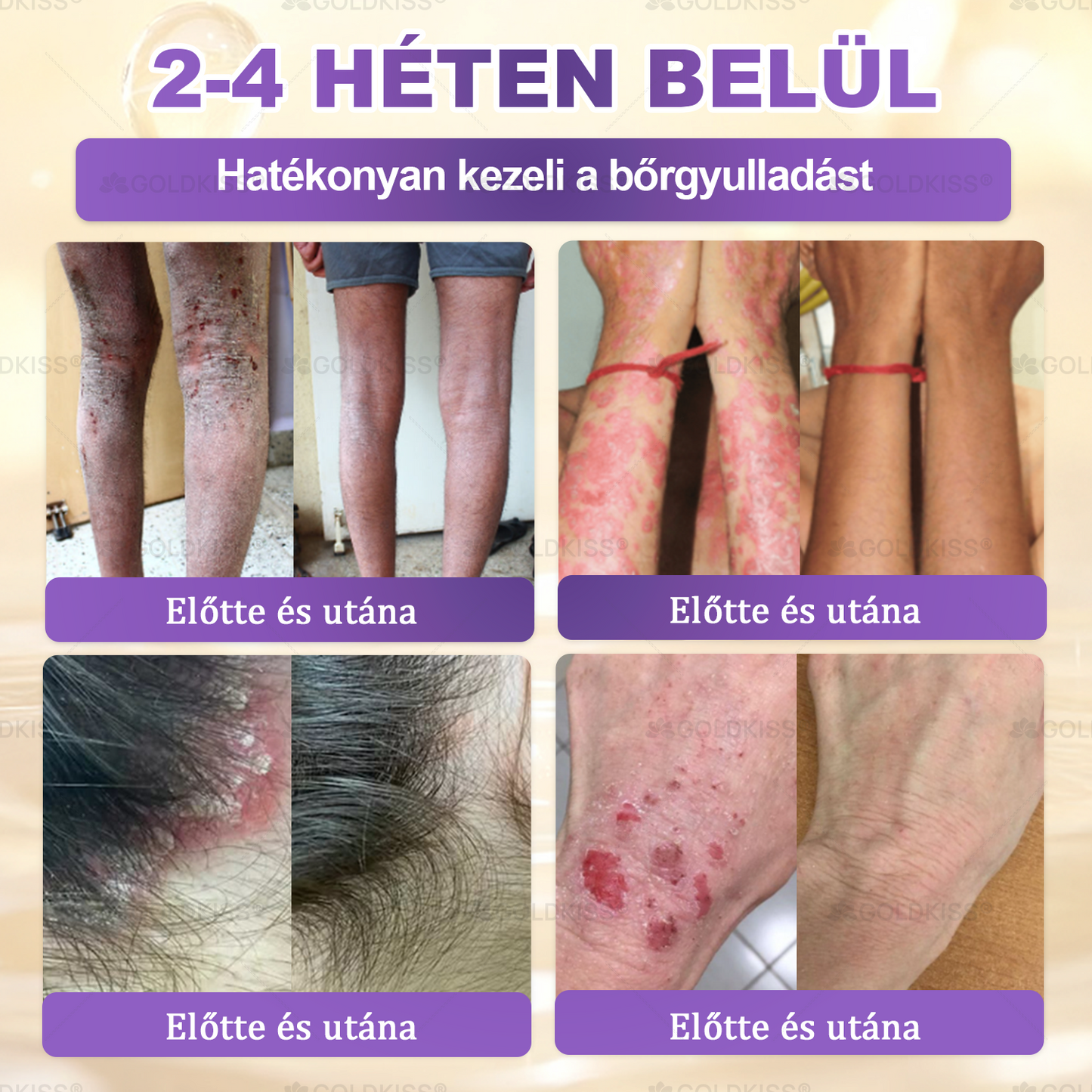 🇭🇺 Magyarországon gyártva és szállítva ✨ 𝐆𝐎𝐋𝐃𝐊𝐈𝐒𝐒® 𝐆𝐇𝐊-𝐂𝐮 & 𝐁𝐈𝐎𝐓𝐈𝐍 𝟏𝟎-𝐢𝐧-𝟏 Bőrmegújító Krém ⚡
