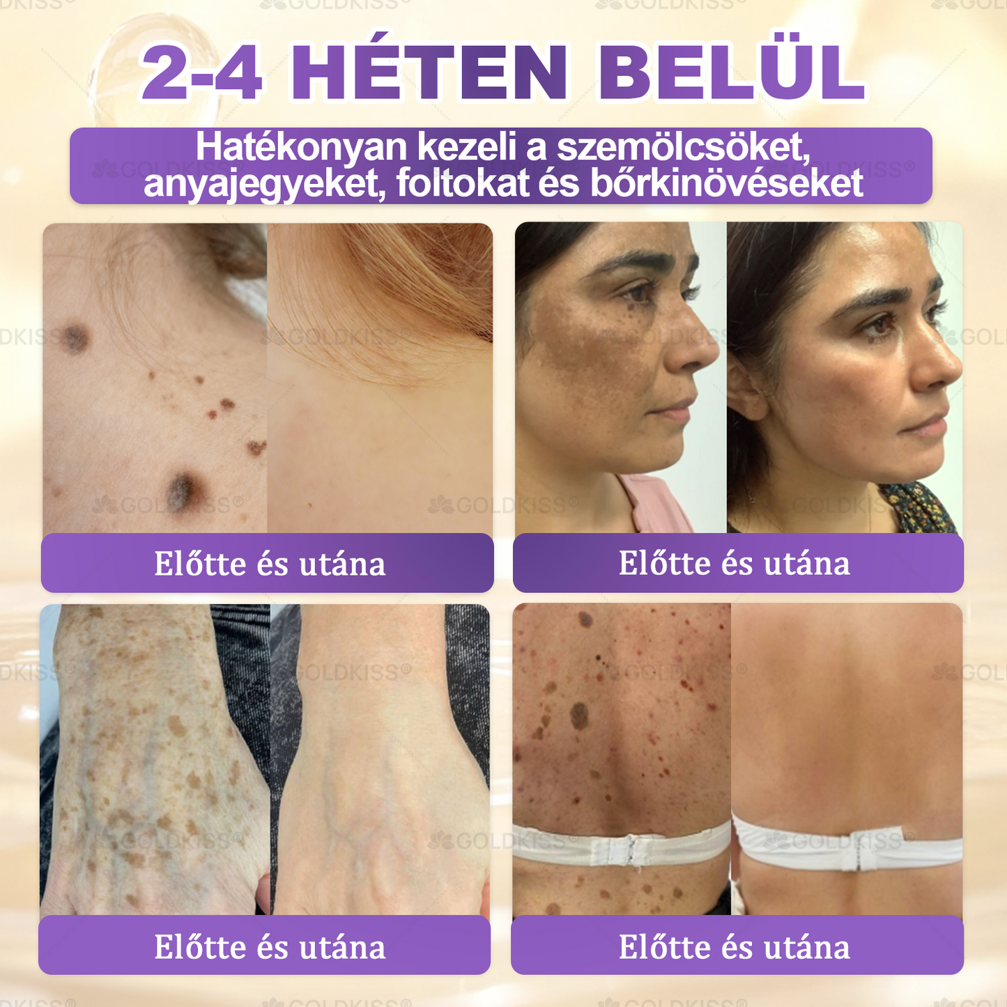 🇭🇺 Magyarországon gyártva és szállítva ✨ 𝐆𝐎𝐋𝐃𝐊𝐈𝐒𝐒® 𝐆𝐇𝐊-𝐂𝐮 & 𝐁𝐈𝐎𝐓𝐈𝐍 𝟏𝟎-𝐢𝐧-𝟏 Bőrmegújító Krém ⚡