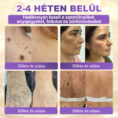 🇭🇺 Magyarországon gyártva és szállítva ✨ 𝐆𝐎𝐋𝐃𝐊𝐈𝐒𝐒® 𝐆𝐇𝐊-𝐂𝐮 & 𝐁𝐈𝐎𝐓𝐈𝐍 𝟏𝟎-𝐢𝐧-𝟏 Bőrmegújító Krém ⚡