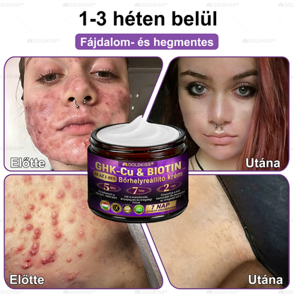 🇭🇺 Magyarországon gyártva és szállítva ✨ 𝐆𝐎𝐋𝐃𝐊𝐈𝐒𝐒® 𝐆𝐇𝐊-𝐂𝐮 & 𝐁𝐈𝐎𝐓𝐈𝐍 𝟏𝟎-𝐢𝐧-𝟏 Bőrmegújító Krém ⚡