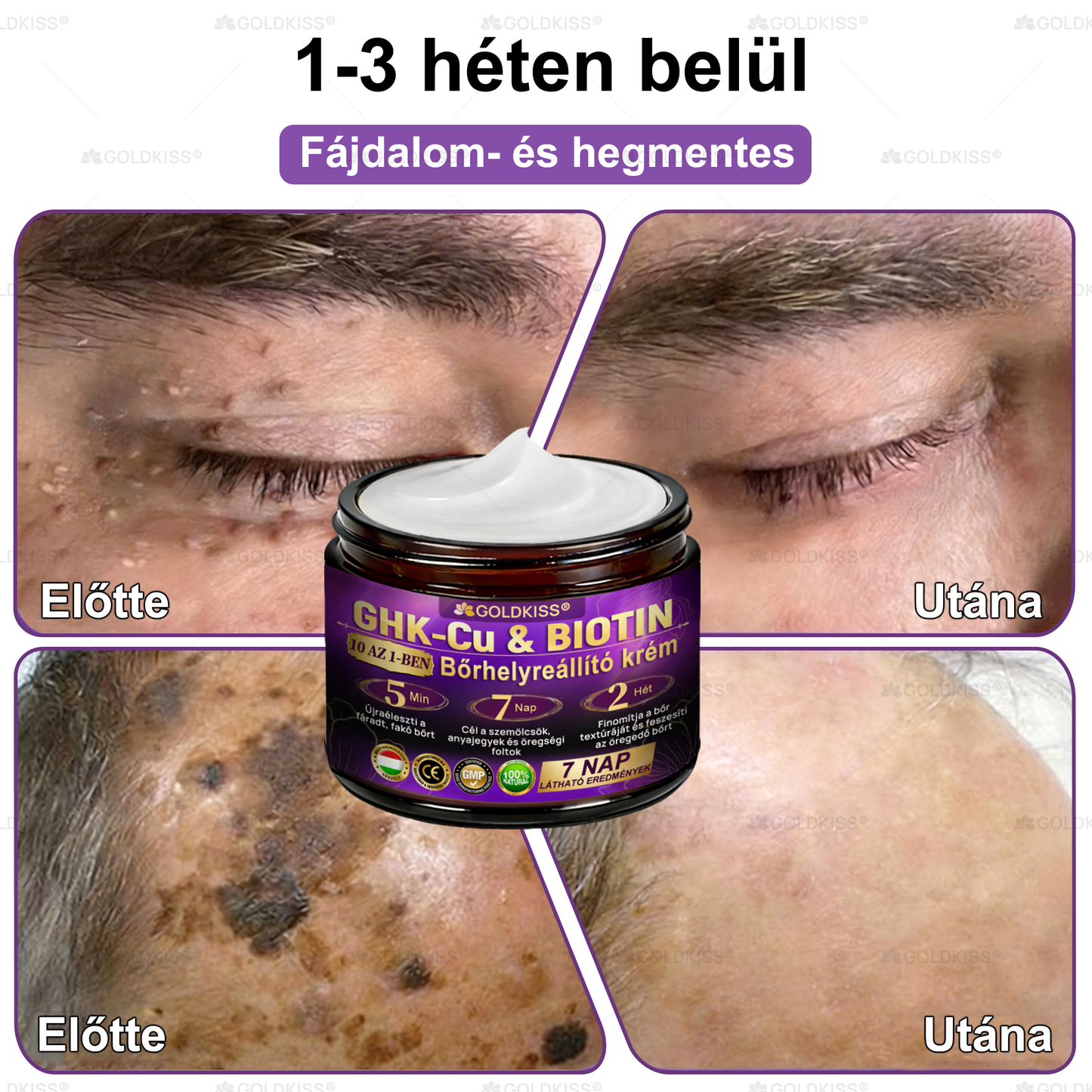 🇭🇺 Magyarországon gyártva és szállítva ✨ 𝐆𝐎𝐋𝐃𝐊𝐈𝐒𝐒® 𝐆𝐇𝐊-𝐂𝐮 & 𝐁𝐈𝐎𝐓𝐈𝐍 𝟏𝟎-𝐢𝐧-𝟏 Bőrmegújító Krém ⚡