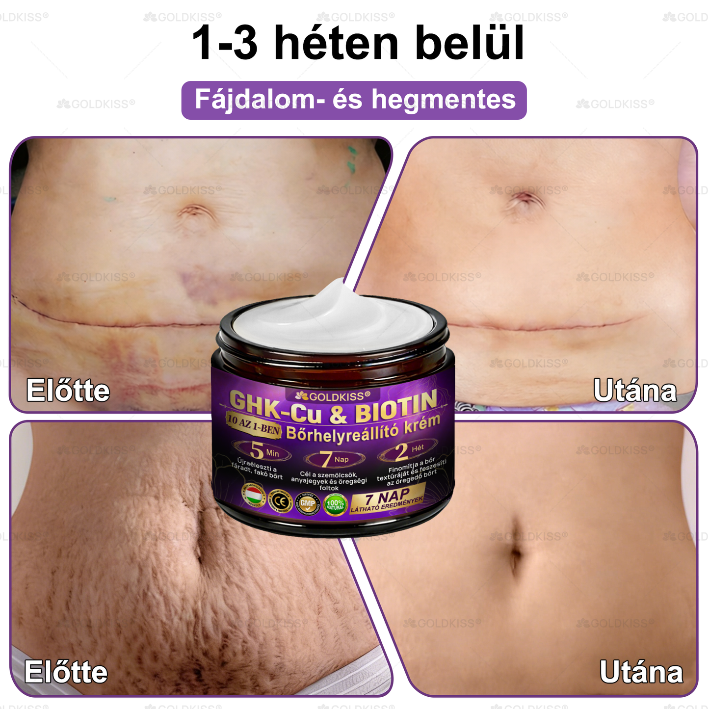 🇭🇺 Magyarországon gyártva és szállítva ✨ 𝐆𝐎𝐋𝐃𝐊𝐈𝐒𝐒® 𝐆𝐇𝐊-𝐂𝐮 & 𝐁𝐈𝐎𝐓𝐈𝐍 𝟏𝟎-𝐢𝐧-𝟏 Bőrmegújító Krém ⚡
