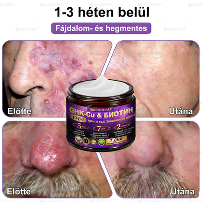 🇭🇺 Magyarországon gyártva és szállítva ✨ 𝐆𝐎𝐋𝐃𝐊𝐈𝐒𝐒® 𝐆𝐇𝐊-𝐂𝐮 & 𝐁𝐈𝐎𝐓𝐈𝐍 𝟏𝟎-𝐢𝐧-𝟏 Bőrmegújító Krém ⚡