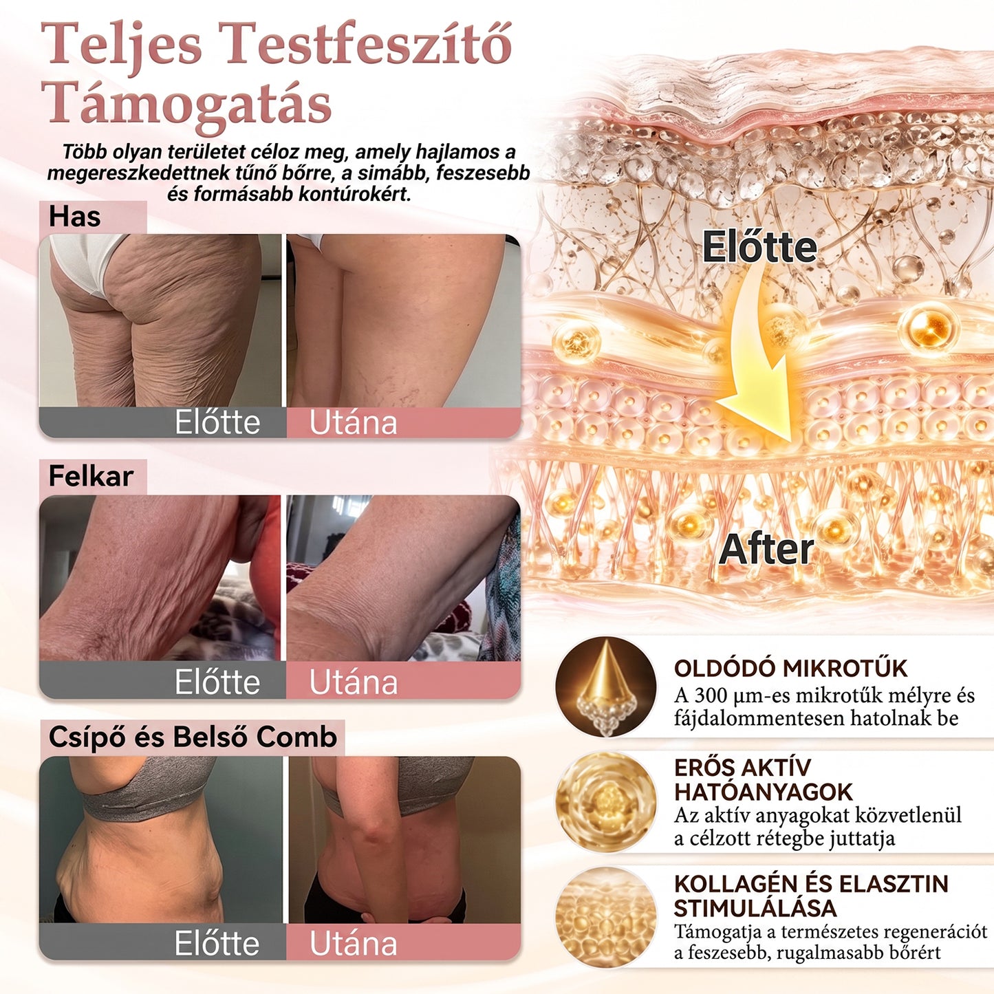 ❣️HISKIN® MELLEMELŐ ÉS FESZESÍTŐ MIKROTŰS TAPASZOK