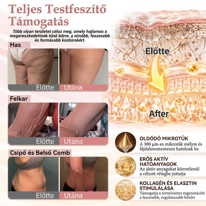 ❣️HISKIN® MELLEMELŐ ÉS FESZESÍTŐ MIKROTŰS TAPASZOK