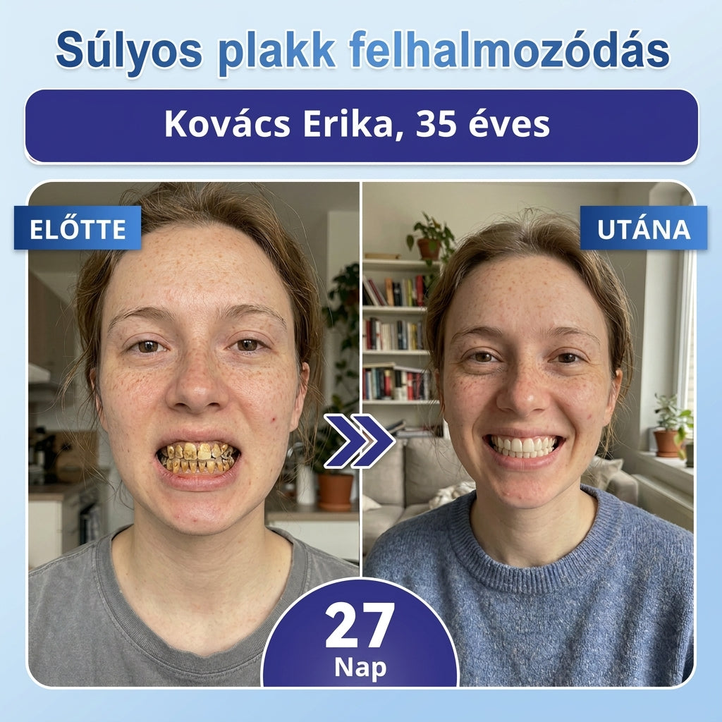 🤎🇭🇺🦷 Mondj búcsút az érzékenységnek és kellemetlenségeknek! 𝐂𝐨𝐚𝐮𝐨𝐨® Tideglusib szájcsíkok – gyors regenerálás a fogaknak és az ínynek 😊