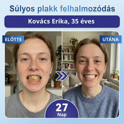 🤎🇭🇺🦷 Mondj búcsút az érzékenységnek és kellemetlenségeknek! 𝐂𝐨𝐚𝐮𝐨𝐨® Tideglusib szájcsíkok – gyors regenerálás a fogaknak és az ínynek 😊