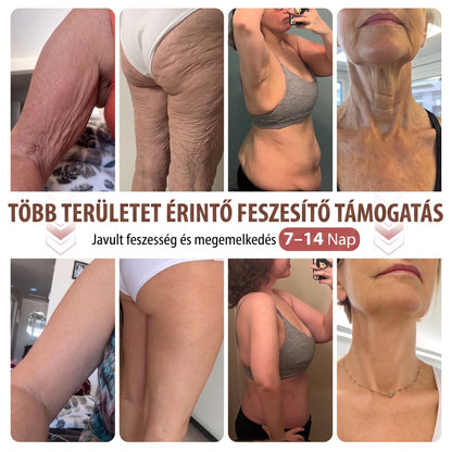 ❣️HISKIN® MELLEMELŐ ÉS FESZESÍTŐ MIKROTŰS TAPASZOK