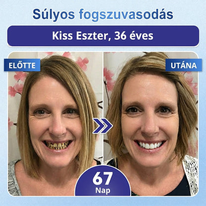 🤎🇭🇺🦷 Mondj búcsút az érzékenységnek és kellemetlenségeknek! 𝐂𝐨𝐚𝐮𝐨𝐨® Tideglusib szájcsíkok – gyors regenerálás a fogaknak és az ínynek 😊