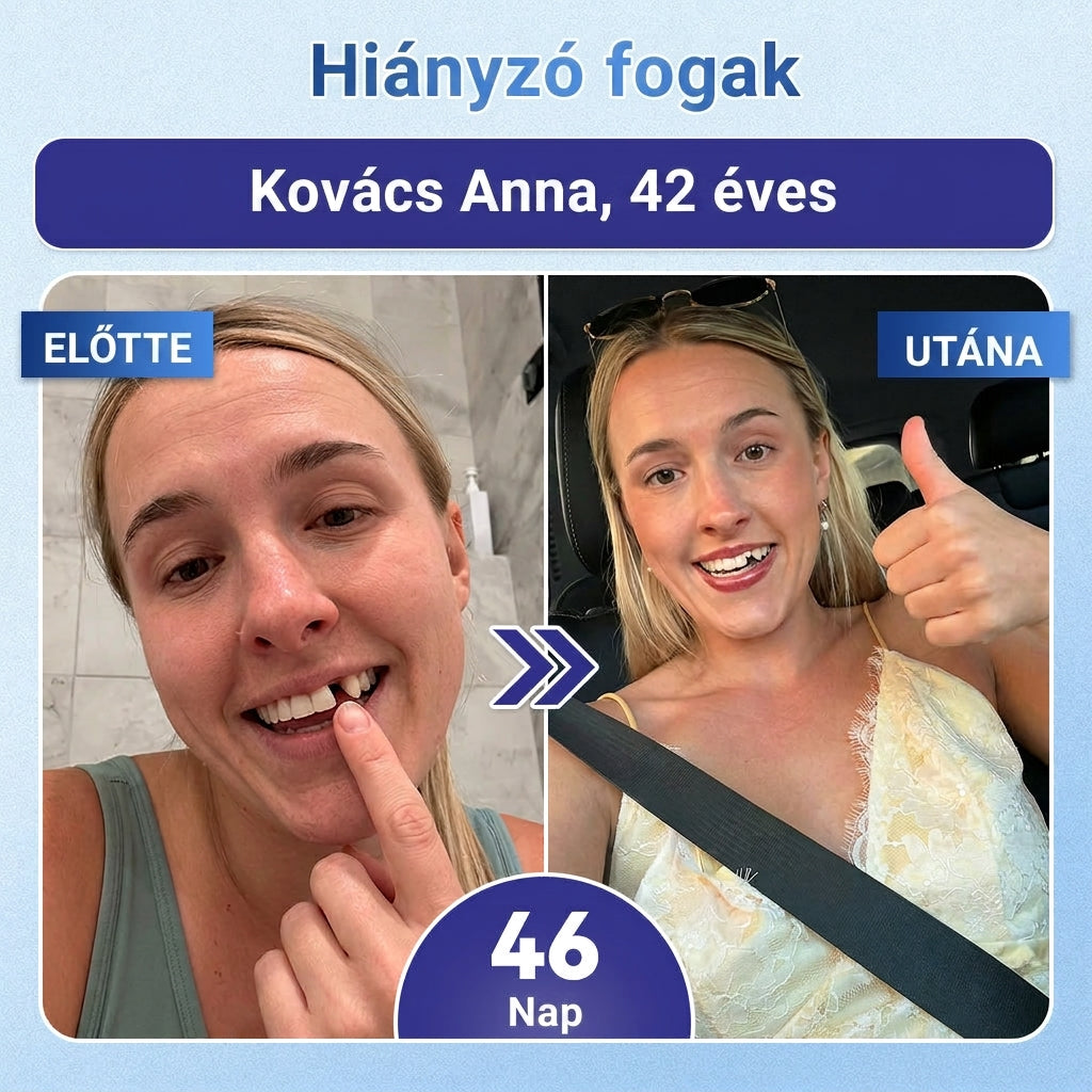 🤎🇭🇺🦷 Mondj búcsút az érzékenységnek és kellemetlenségeknek! 𝐂𝐨𝐚𝐮𝐨𝐨® Tideglusib szájcsíkok – gyors regenerálás a fogaknak és az ínynek 😊