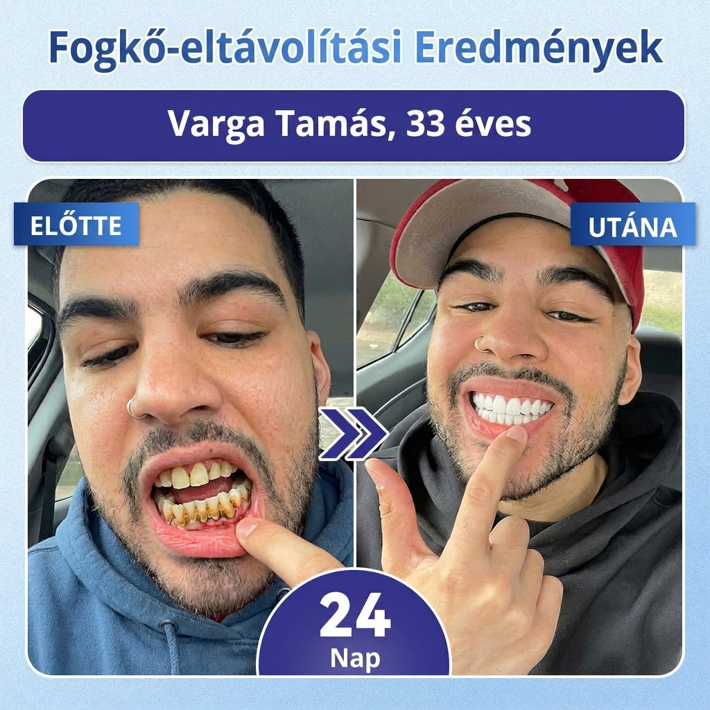 🤎🇭🇺🦷 Mondj búcsút az érzékenységnek és kellemetlenségeknek! 𝐂𝐨𝐚𝐮𝐨𝐨® Tideglusib szájcsíkok – gyors regenerálás a fogaknak és az ínynek 😊
