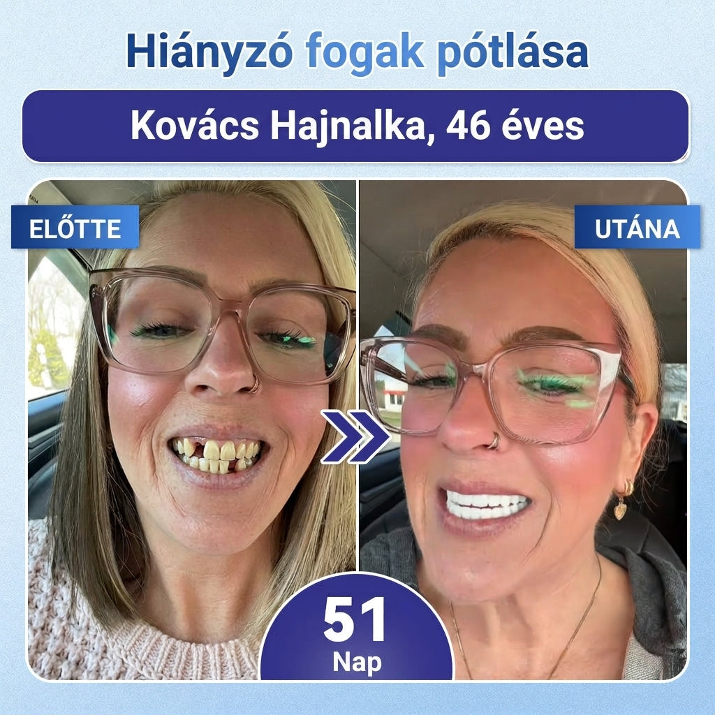 🤎🇭🇺🦷 Mondj búcsút az érzékenységnek és kellemetlenségeknek! 𝐂𝐨𝐚𝐮𝐨𝐨® Tideglusib szájcsíkok – gyors regenerálás a fogaknak és az ínynek 😊