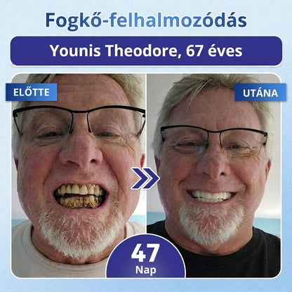 🤎🇭🇺🦷 Mondj búcsút az érzékenységnek és kellemetlenségeknek! 𝐂𝐨𝐚𝐮𝐨𝐨® Tideglusib szájcsíkok – gyors regenerálás a fogaknak és az ínynek 😊